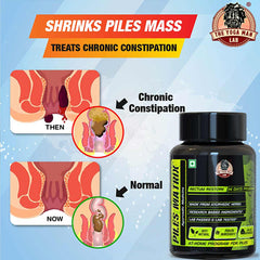 PILES MATRIX - RECTUM RESTORE Ayurvedic Supplement | Removes Root Cause. Shrinks Piles Lumps & Treats Constipation | 100% Natural